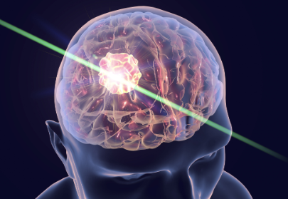 術中成像用藍寶石